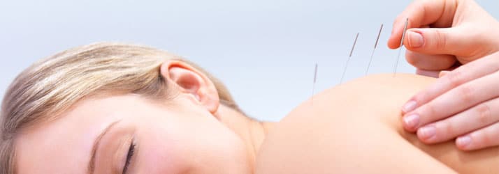 Chiropractic Oakbrook Terrace IL Acupunture