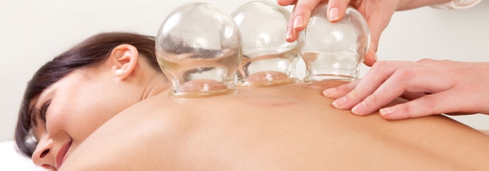 Chiropractic Oakbrook Terrace IL Cupping Treatment