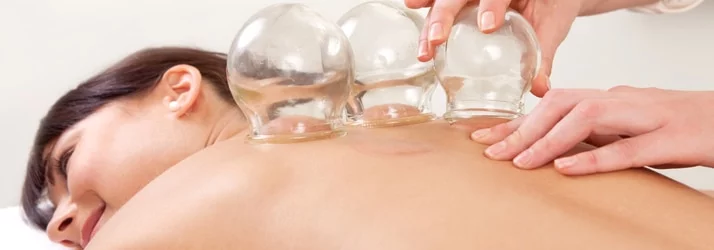 Chiropractic Oakbrook Terrace IL Cupping Treatment