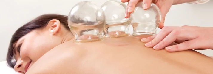 Chiropractic Oakbrook Terrace IL Cupping Treatment Chiropractic Oakbrook Terrace IL Cupping Treatment